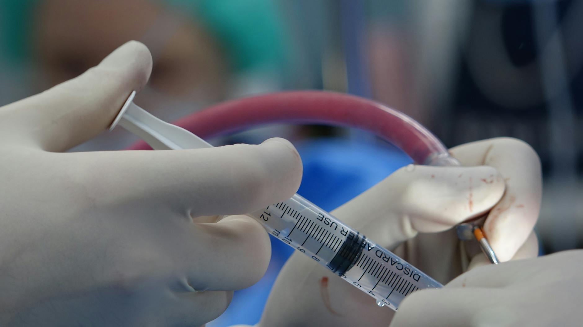 Why GERD Clinical Trials Pay More Than Focus Groups